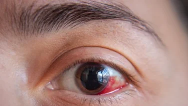 ¿Por qué se nubla la vista? Esto dice la ciencia