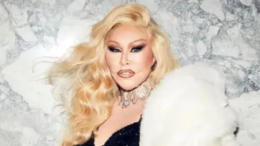 Muere Jocelyn Wildenstein, mejor conocida como la "mujer gato" (+Detalles) Muere Jocelyn Wildenstein, mejor conocida como la "mujer gato" (+Detalles)