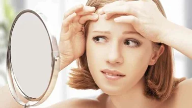 Consejos para evitar brotes de acné y lucir un cutis impecable