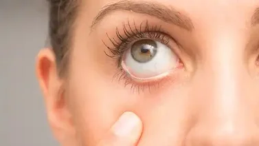 ¿Por qué tiembla el ojo repentinamente?  