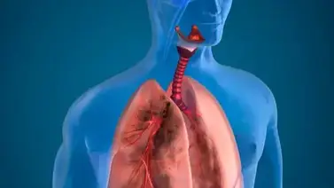 El remedio casero para limpiar los pulmones fácilmente El remedio casero para limpiar los pulmones fácilmente