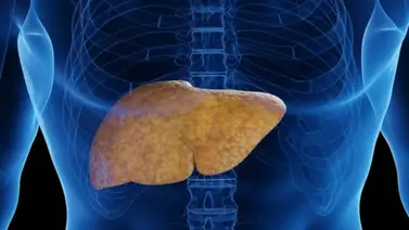 Limpia el hígado graso de manera natural con esta infusión casera Limpia el hígado graso de manera natural con esta infusión casera