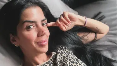 Erika Schwarzgruber está inconforme con su cirugía de nariz: ¿Se realizará otra operación? Erika Schwarzgruber está inconforme con su cirugía de nariz: ¿Se realizará otra operación?