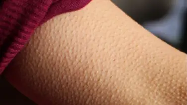 Órganos del cuerpo que pueden dañarse cuando hay bajas temperaturas Órganos del cuerpo que pueden dañarse cuando hay bajas temperaturas