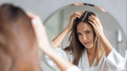 Que el cabello graso no afecte tu confianza ¡Aprende a cuidarlo!