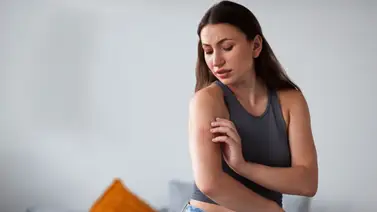 ¿Tienes un área escamosa en forma de anillo en la piel?: Entérate cuáles son las posibles causas y cómo tratarla ¿Tienes un área escamosa en forma de anillo en la piel?: Entérate cuáles son las posibles causas y cómo tratarla