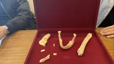 2001online - Marruecos - restos humanos 2001online - Marruecos - restos humanos