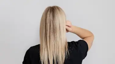 Hidratación casera para el cabello decolorado: esta es la mascarilla natural rica en vitaminas Hidratación casera para el cabello decolorado: esta es la mascarilla natural rica en vitaminas