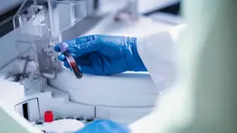 Emergencia sanitaria: India lucha por contener brote del letal virus Nipah