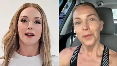 ¡Unos retoques de más! Laura Flores habla sobre las críticas que enfrenta por los cambios en su rostro ¡Unos retoques de más! Laura Flores habla sobre las críticas que enfrenta por los cambios en su rostro