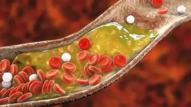 Esta es la planta medicinal que reduce el nivel del colesterol Esta es la planta medicinal que reduce el nivel del colesterol