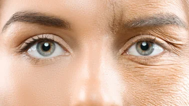 Luce un rostro sin arrugas con esta mascarilla de aloe vera y arroz