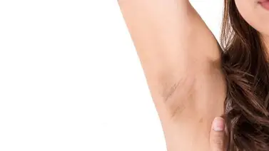 ¿Axilas manchadas? Entérate qué puedes hacer para aclararlas  ¿Axilas manchadas? Entérate qué puedes hacer para aclararlas