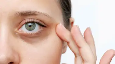 Dile adiós a las feas, pero comunes, ojeras bajo los ojos Dile adiós a las feas, pero comunes, ojeras bajo los ojos