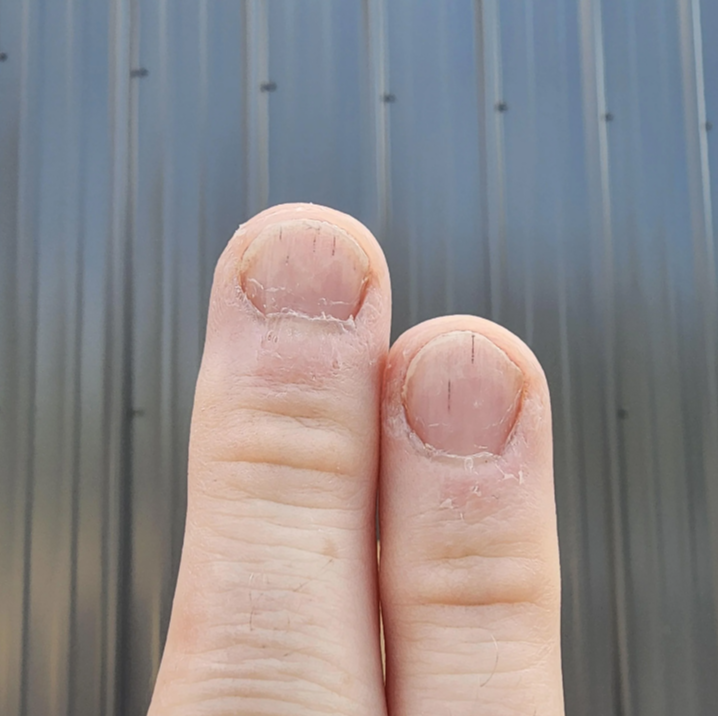 ¿Por qué salen manchas negras en las uñas y cómo eliminarlas? 