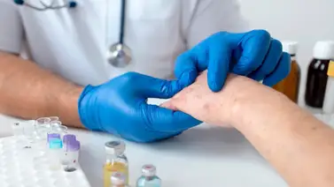 Cuidados que debe tener un paciente con sarampión Cuidados que debe tener un paciente con sarampión
