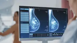 Harán mamografías con IA: se podrá diagnosticar más cánceres 