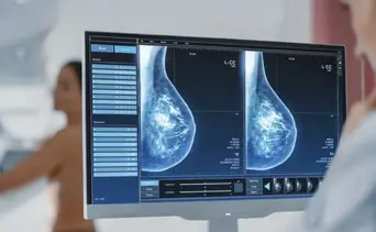 Harán mamografías con IA: se podrá diagnosticar más cánceres 
