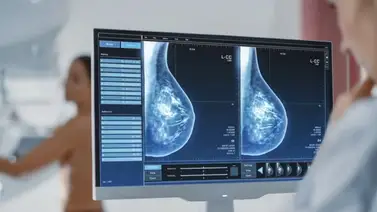 Harán mamografías con IA: se podrá diagnosticar más cánceres Harán mamografías con IA: se podrá diagnosticar más cánceres
