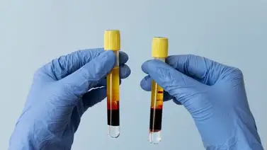 La maravillosa semilla rica en vitamina E que controla el nivel de los triglicéridos: esta es la cantidad que debes consumir La maravillosa semilla rica en vitamina E que controla el nivel de los triglicéridos: esta es la cantidad que debes consumir