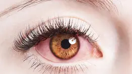 ¿Por qué se enrojecen los ojos? Guía para recuperar una mirada descansada