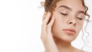 Fórmula casera para eliminar las manchas de la piel sin necesidad de utilizar productos químicos Fórmula casera para eliminar las manchas de la piel sin necesidad de utilizar productos químicos