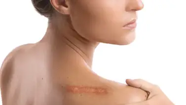 Servicio gratis: invitan a jornada de cicatrices el hospital Domingo Luciani Servicio gratis: invitan a jornada de cicatrices el hospital Domingo Luciani