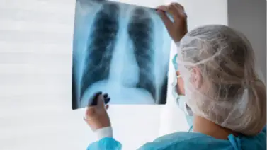 Salud respiratoria bajo la lupa: cómo identificar si es una alergia o un virus para un tratamiento efectivo Salud respiratoria bajo la lupa: cómo identificar si es una alergia o un virus para un tratamiento efectivo