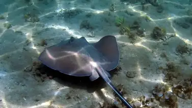 CDI colapsado de bañistas picados por mantarrayas en el Zulia: piden no ingresar a playas del municipio Mara CDI colapsado de bañistas picados por mantarrayas en el Zulia: piden no ingresar a playas del municipio Mara