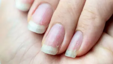 De este modo deberás cuidar tus uñas luego de retirar la manicura permanente De este modo deberás cuidar tus uñas luego de retirar la manicura permanente