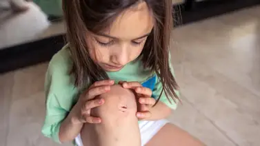 ¿Una herida? Este antiséptico es mejor que el alcohol y agua oxigenada ¿Una herida? Este antiséptico es mejor que el alcohol y agua oxigenada