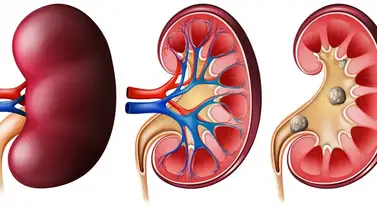 Entérate de cuál es la hierba que mantiene los riñones en buen funcionamiento Entérate de cuál es la hierba que mantiene los riñones en buen funcionamiento