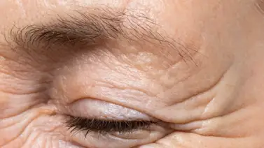 Retrasa la aparición de arrugas: este es el alimento lleno de colágeno que fortalece la piel Retrasa la aparición de arrugas: este es el alimento lleno de colágeno que fortalece la piel