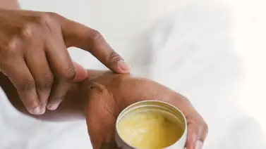 Advierten sobre el uso de 22 productos para aclarar la piel en USA: esta es la razón Advierten sobre el uso de 22 productos para aclarar la piel en USA: esta es la razón