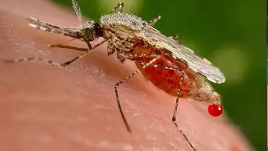 Virus Oropouche: ministerio de salud confirma los primeros casos detectados en Venezuela Virus Oropouche: ministerio de salud confirma los primeros casos detectados en Venezuela