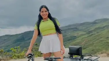 ¡Impactante! Este es el antes y después de la influencer venezolana Andreina Perdomo tras cirugía estética ¡Impactante! Este es el antes y después de la influencer venezolana Andreina Perdomo tras cirugía estética