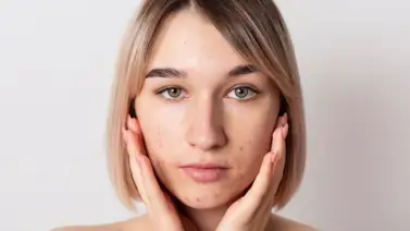 Aclara la piel del rostro con una mascarilla natural de dos ingredientes Aclara la piel del rostro con una mascarilla natural de dos ingredientes