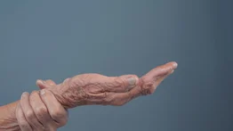 Combate las arrugas de las manos con esta mascarilla rica en colágeno