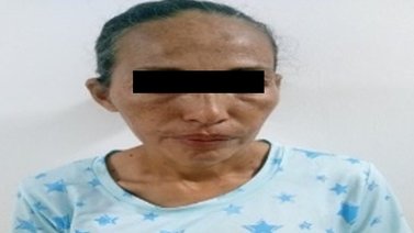 Adolescente escapa del maltrato físico de su madre en Tucacas: tomó un blister de  pastillas anticonvulsivas 