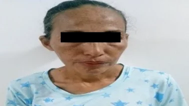 Adolescente escapa del maltrato físico de su madre en Tucacas: tomó un blister de  pastillas anticonvulsivas 