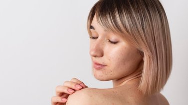 Así debes utilizar el limón para aclarar las manchas en la piel