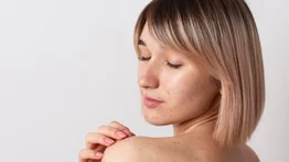 Así debes utilizar el limón para aclarar las manchas en la piel
