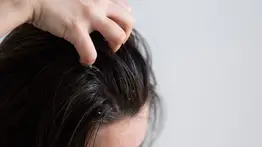 ¡Cabello limpio! Elimina la grasa con este ingrediente de cocina rico en vitaminas