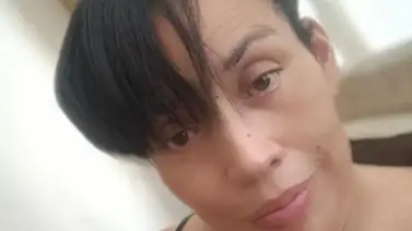 Servicio Público | Mary Cordero solicita apoyo para intervención cerebral especializada Servicio Público | Mary Cordero solicita apoyo para intervención cerebral especializada