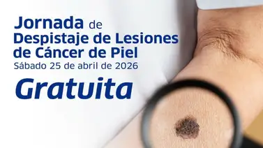Jornada gratuita para frenar el avance del cáncer de piel en Caracas: 25 de abril Jornada gratuita para frenar el avance del cáncer de piel en Caracas: 25 de abril
