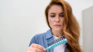 Estas son las vitaminas que previenen la caída del cabello: inclúyelas a través de estos alimentos muy populares Estas son las vitaminas que previenen la caída del cabello: inclúyelas a través de estos alimentos muy populares