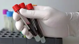 Texas ofrece tratamiento gratuito contra VIH: conoce dónde y cómo acceder sin costo