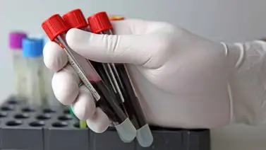 Texas ofrece tratamiento gratuito contra VIH: conoce dónde y cómo acceder sin costo Texas ofrece tratamiento gratuito contra VIH: conoce dónde y cómo acceder sin costo