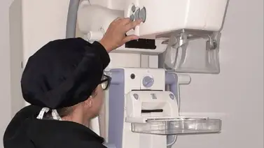 Biopsia por estereotaxia: así se puede evitar una cirugía de mama innecesaria Biopsia por estereotaxia: así se puede evitar una cirugía de mama innecesaria