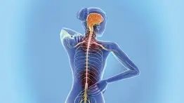 Esclerosis múltiple: las primeras señales que da esta enfermedad